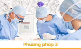 Phương pháp 3